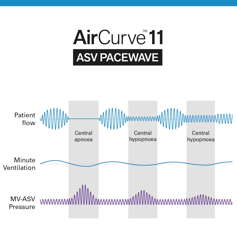 Ein Diagramm, das drei verschiedene Luftdruckströme des AirCurve ASV PaceWave-Algorithmus zeigt.