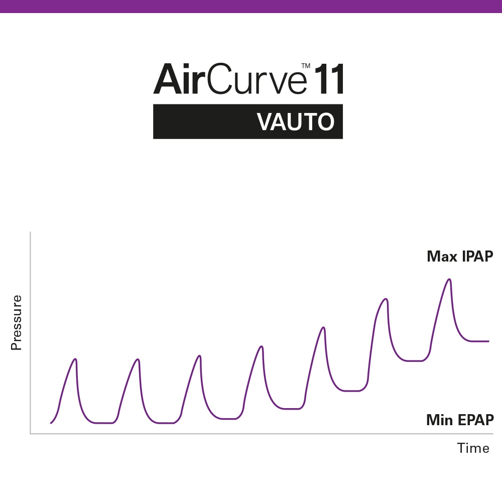 Ein Diagramm, das die Spitzen der Easy-Breathe-Druckkurve des AirCurve 11 VAuto-Geräts zeigt.