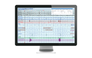 Bildausschnitt mit einem Computerbildschirm mit EasyCare TX 2 Software