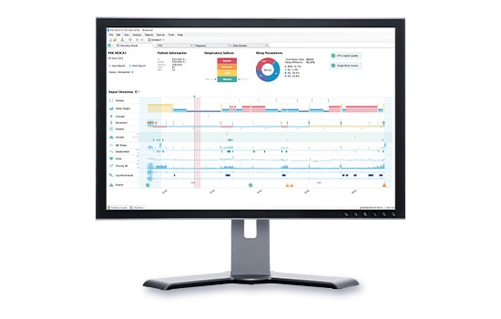 Nox BodySleep Algorithmus