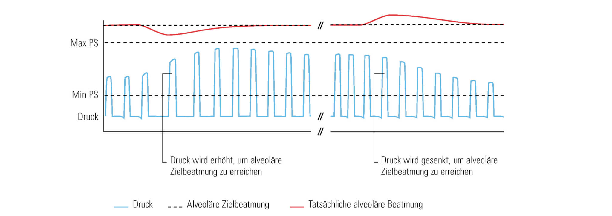 Grafik iVAPS für Beatmung