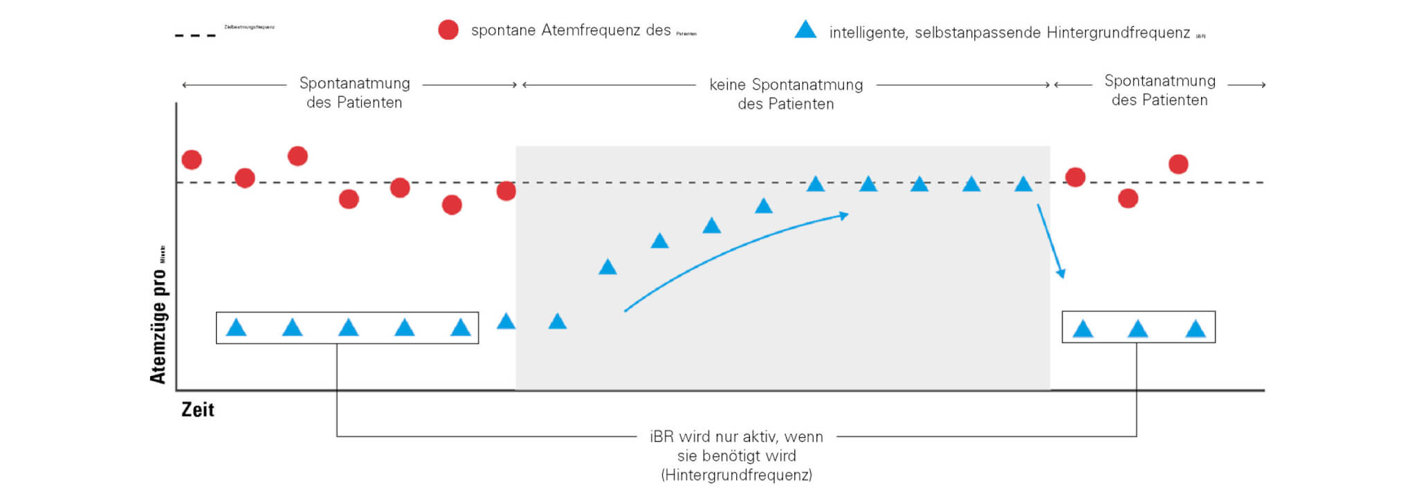 iBR Grafik iVAPS für Beatmung